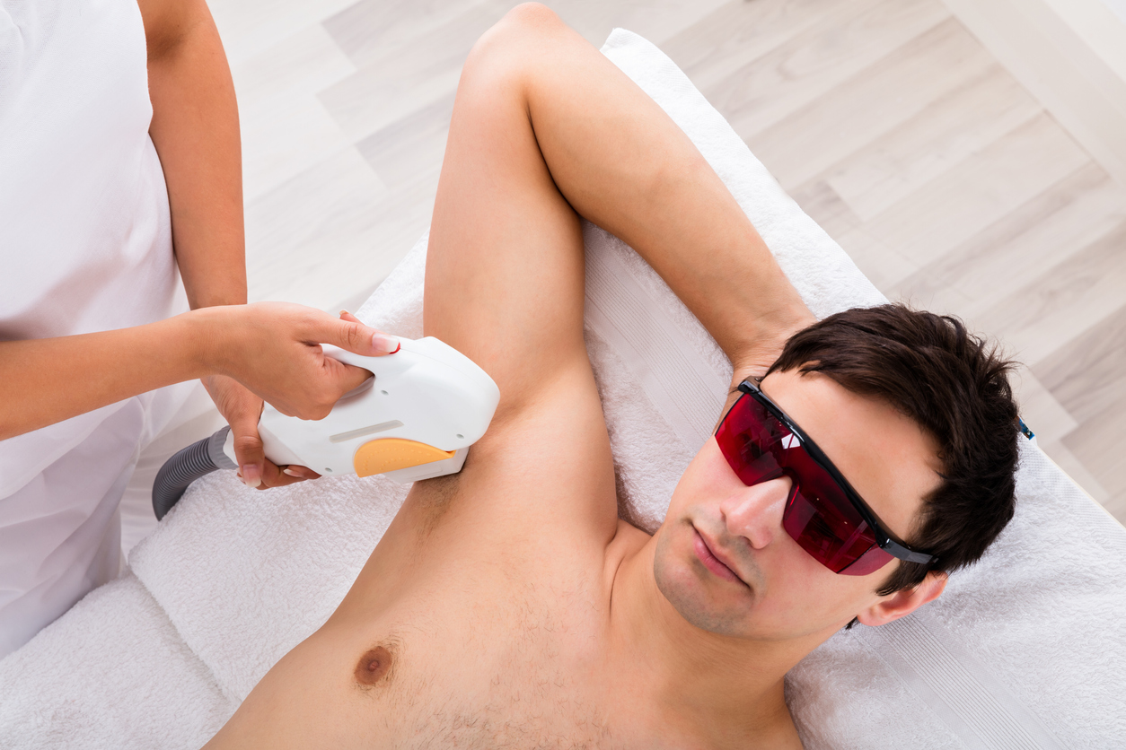 IPL hair removal